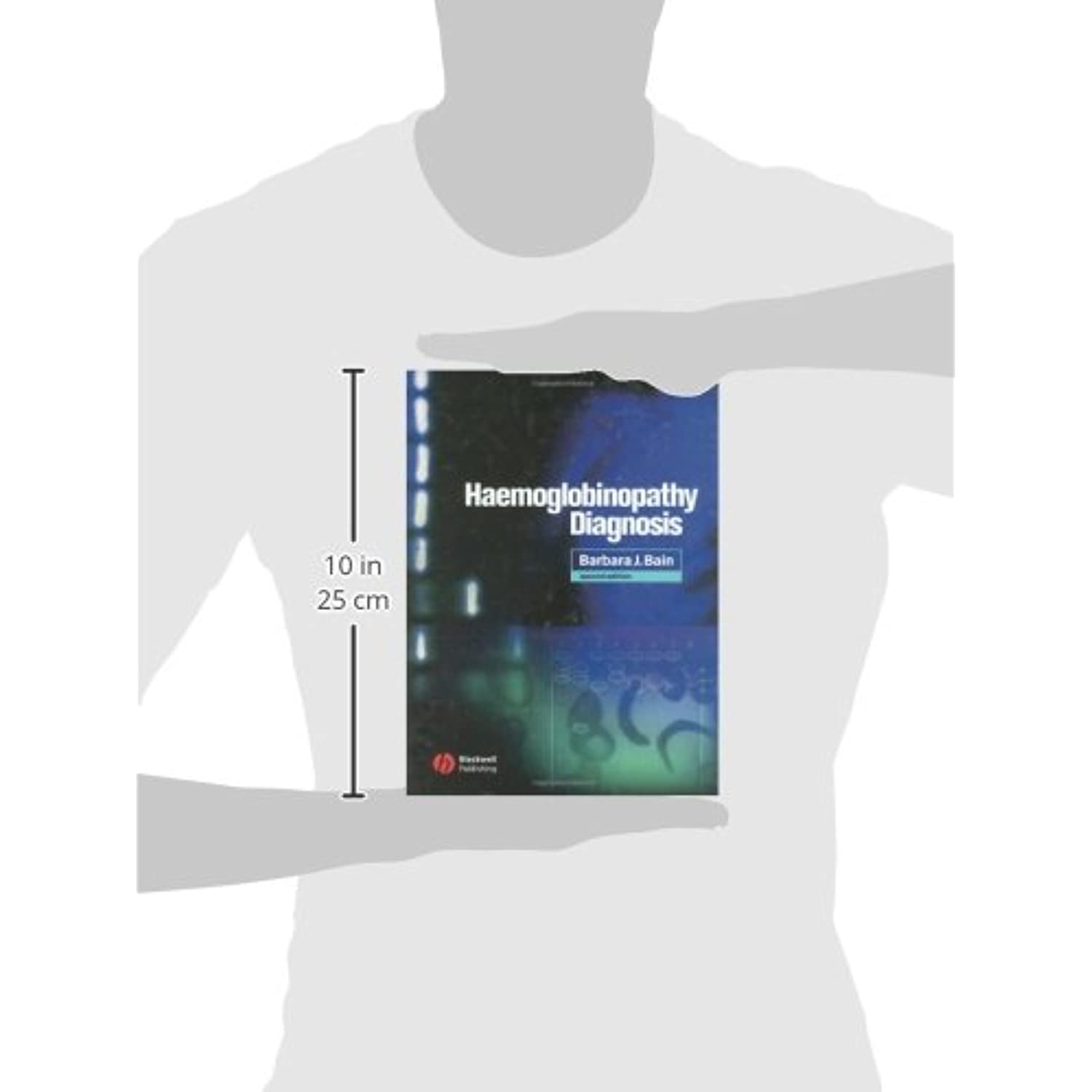 Haemoglobinopathy Diagnosis